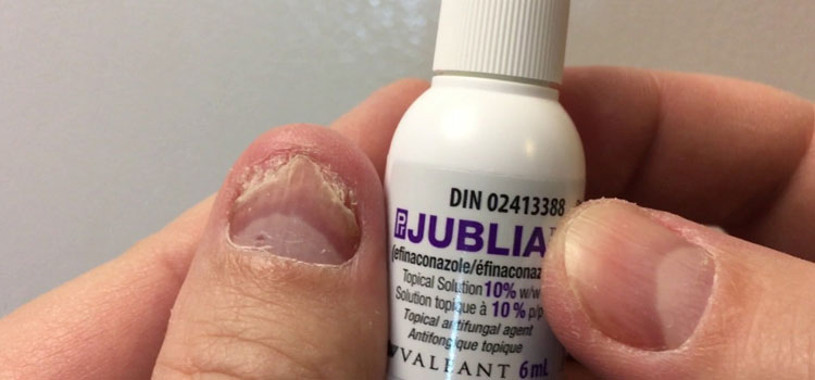 order cheaper jublia online in Mentor, OH